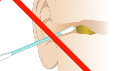oren niet schoonmaken met wattenstaafje